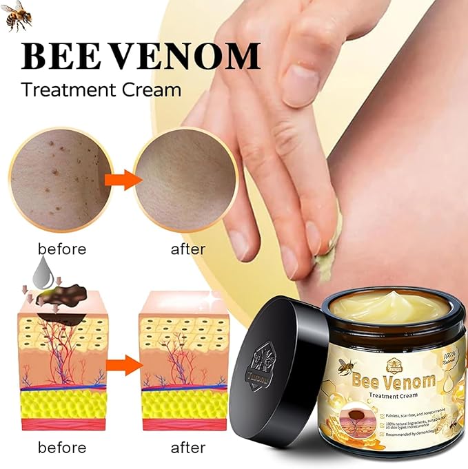 Bee Venom Skin Treatment Cream,Repair Maximum Strength for All Skin Types (2PCS) - Robert errands 