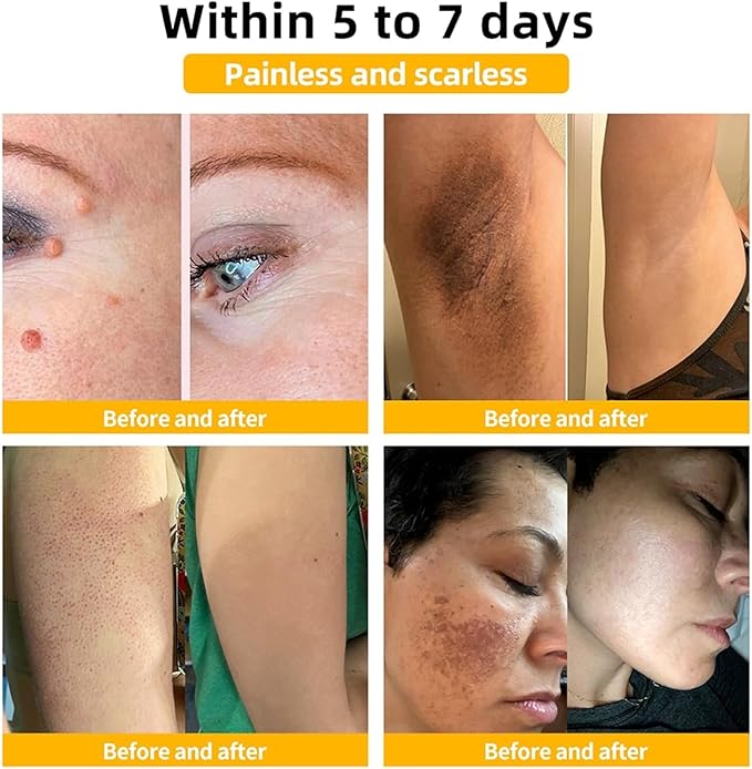 Bee Venom Skin Treatment Cream,Repair Maximum Strength for All Skin Types (2PCS) - Robert errands 