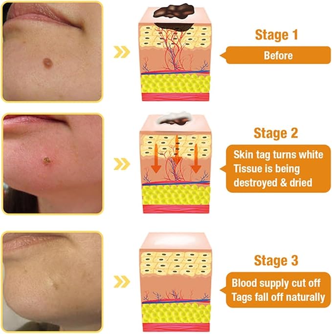 Bee Venom Skin Treatment Cream,Repair Maximum Strength for All Skin Types (2PCS) - Robert errands 