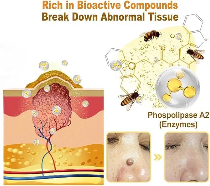 Bee Venom Skin Treatment Cream,Repair Maximum Strength for All Skin Types (2PCS) - Robert errands 